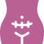 CESÁREAS